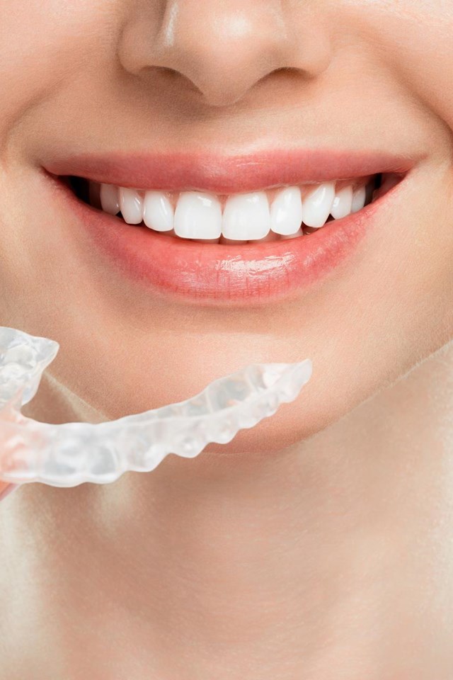 Tratamientos innovadores de estética dental
