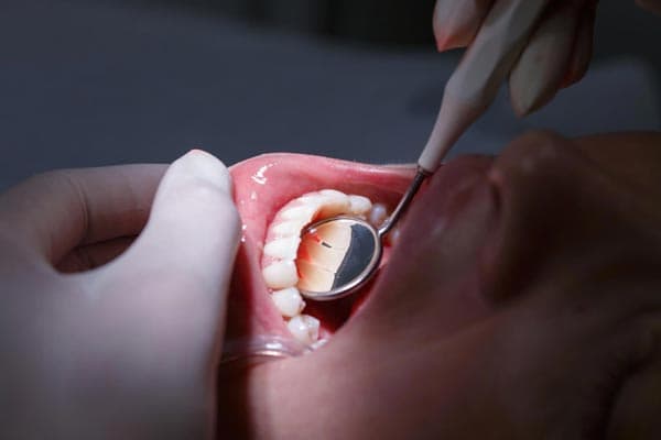 Periodoncia