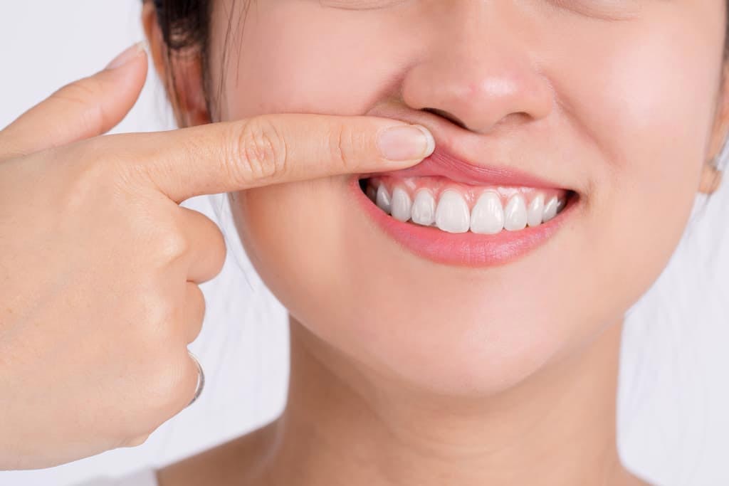 Consecuencias de no tratar las enfermedades periodontales