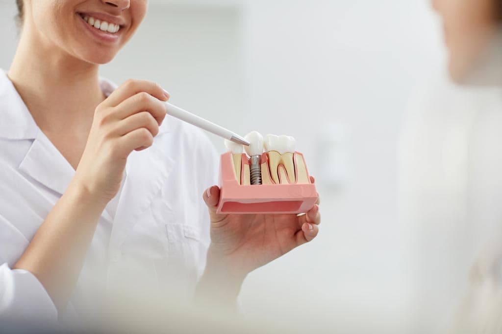 Respondemos sus preguntas sobre implantes dentales en Ourense
