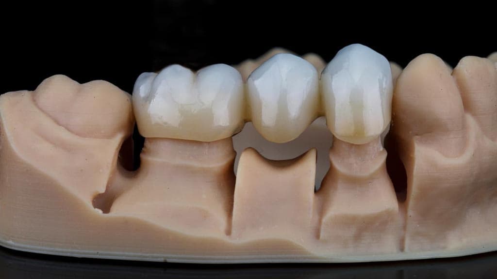 Los expertos en estética dental resuelven todas sus dudas