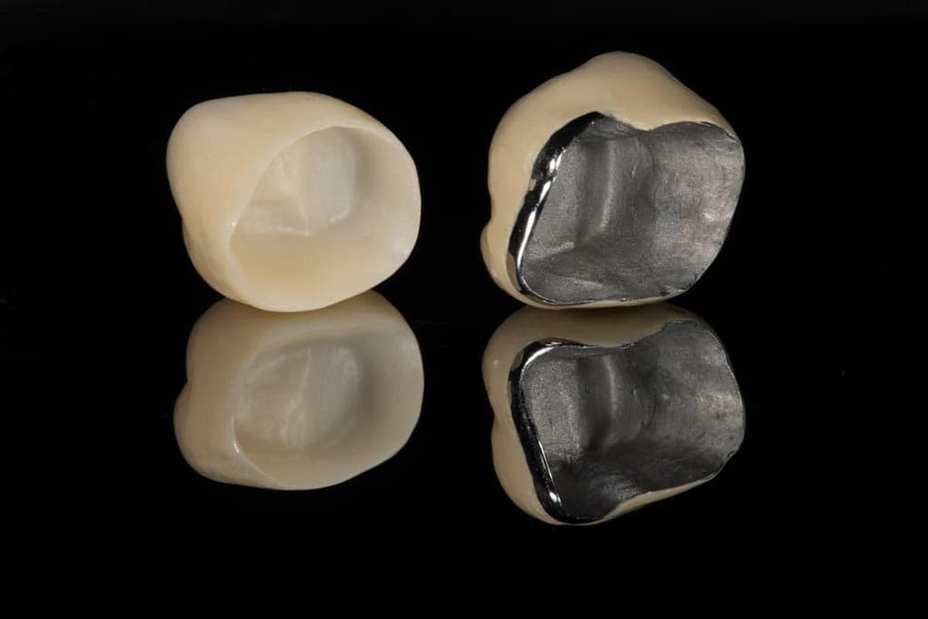 Los expertos en estética dental resuelven todas sus dudas