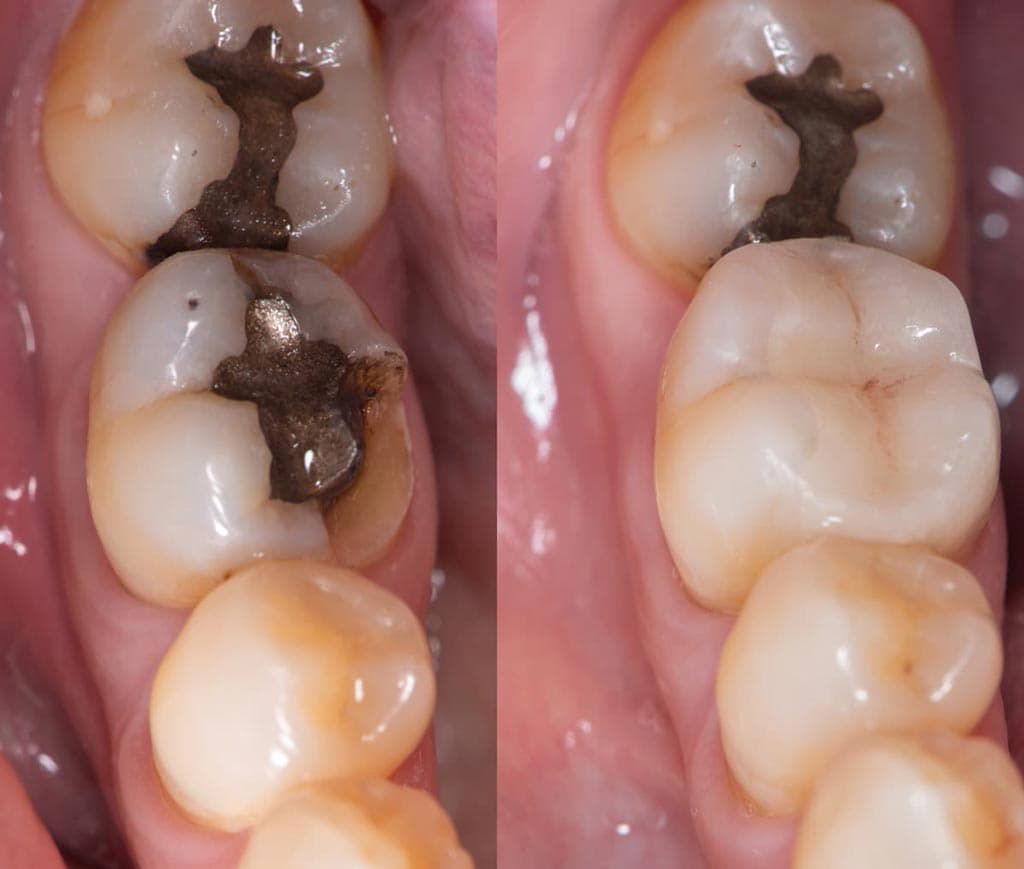 Los expertos en estética dental resuelven todas sus dudas