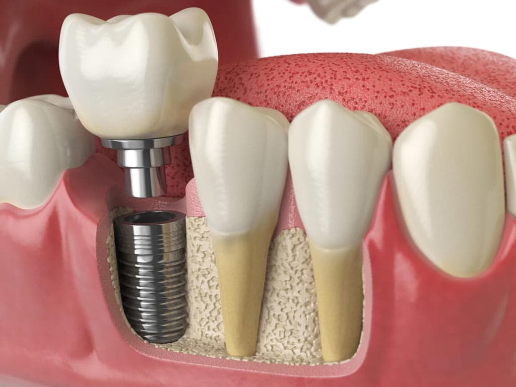 Los expertos en estética dental resuelven todas sus dudas