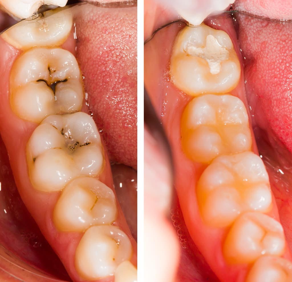La importancia de la odontología general en la salud dental