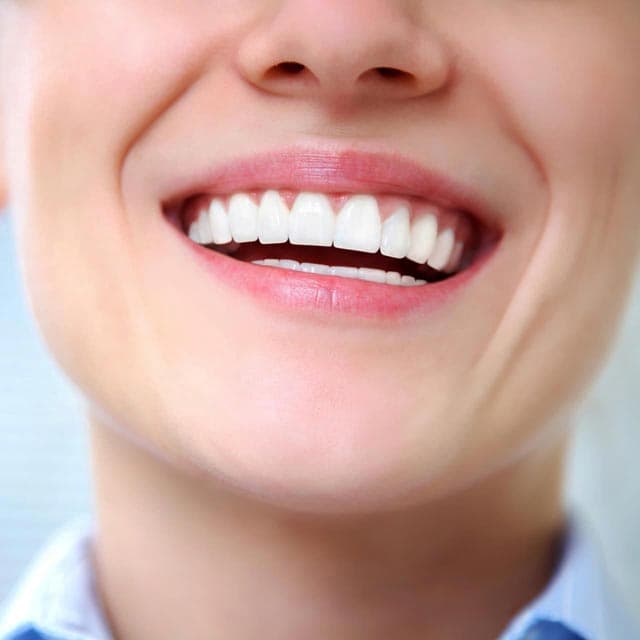 Tratamientos innovadores de estética dental en Ourense
