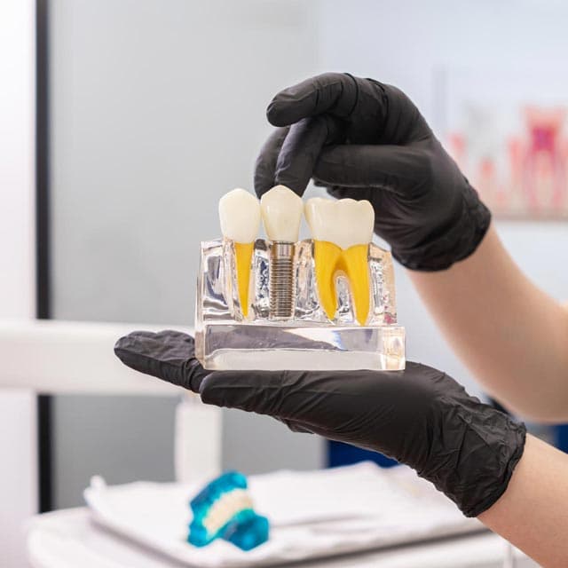 Recupere sus dientes con implantología y cirugía oral en Ourense