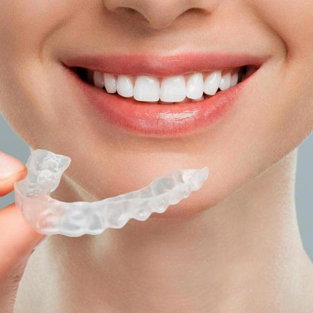 Tratamientos innovadores de estética dental