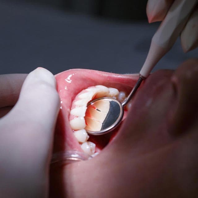 Dentistas especialistas en tratamientos de periodoncia en Ourense