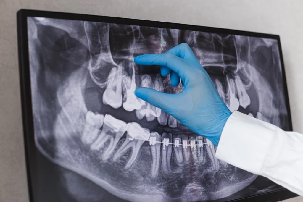 Radiología dental digital en Ourense para un diagnóstico preciso y seguro